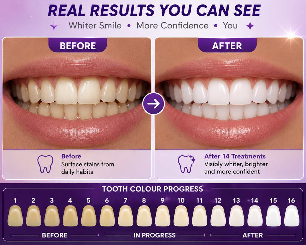 Vitasense Premium PAP + Teeth Whitening Strips. Double pack 28 strips.
