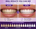 Premium PAP + Teeth Whitening Strips.